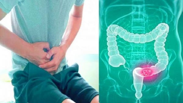 কোষ্ঠকাঠিন্য থেকে মুক্তি পেতে যেসব খাবার বাদ দেবেন