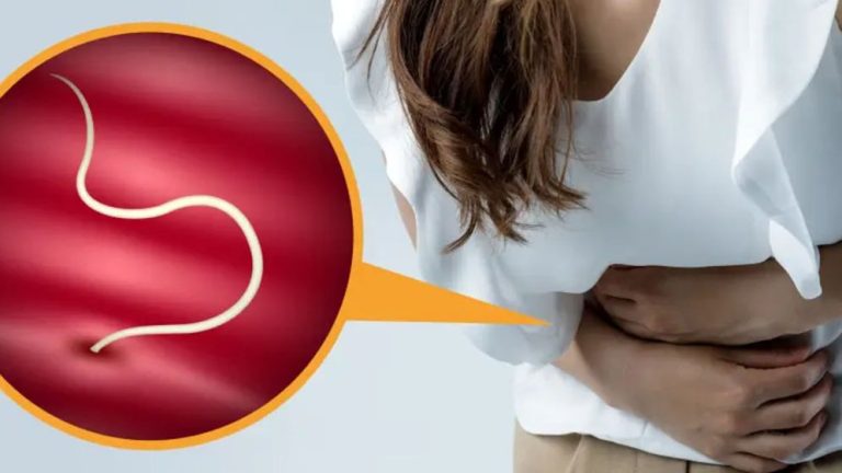 আপনার শরীরে কৃমি বাসা বেঁধেছে কিনা বলে দেবে ৫ লক্ষণ